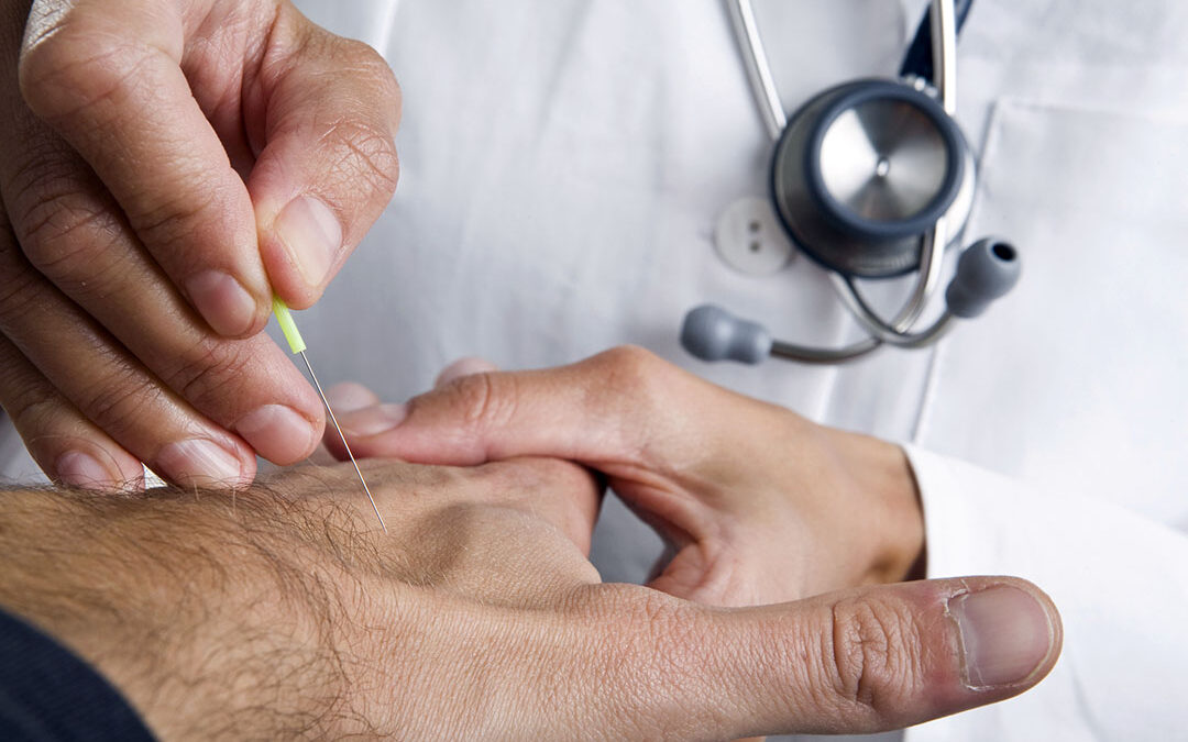 10 Evidence-Based Benefits of Acupuncture