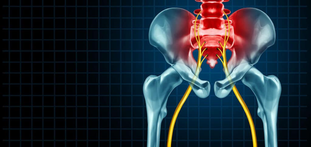 Sciatica Pain: Triggers, Stretches, and Long-Lasting Relief 