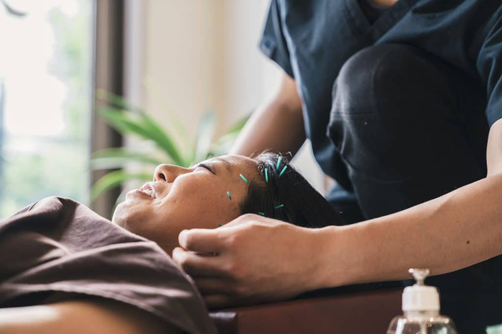 Therapist Giving Cupping Treatment To Young Asian Woman for TMJ or jaw pain relief